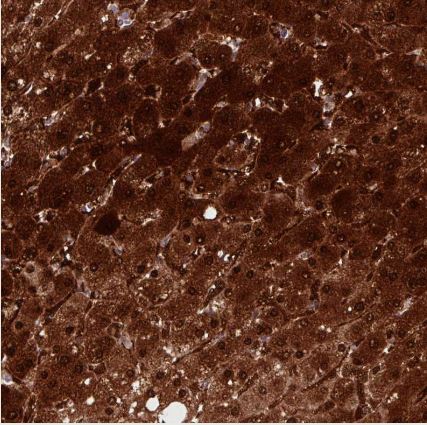 Arginase 1/ARG1/liver Arginase Antibody (CL0186)