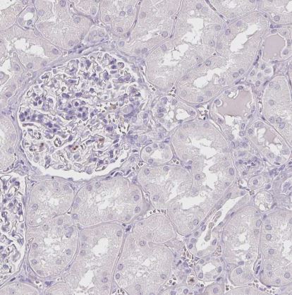 Arginase 1/ARG1/liver Arginase Antibody (CL0186)