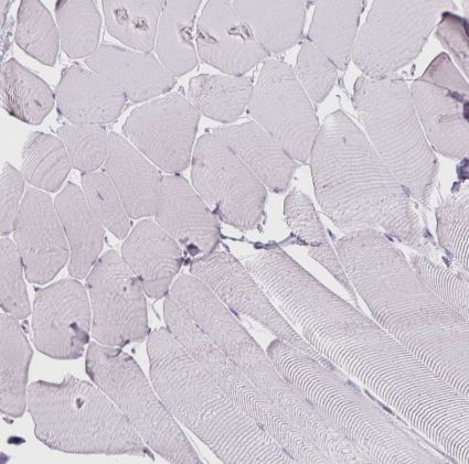 Arginase 1/ARG1/liver Arginase Antibody (CL0186)