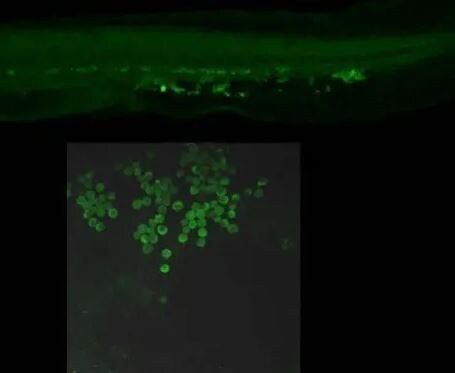 SNF8 Antibody
