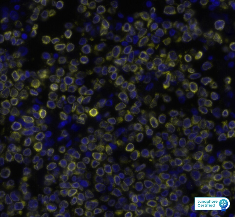 Bcl-2 Antibody (100/D5) Detection of BCL2 in Human Non-Hodgkin’s Lymphoma via seqIF™ staining on COMET™