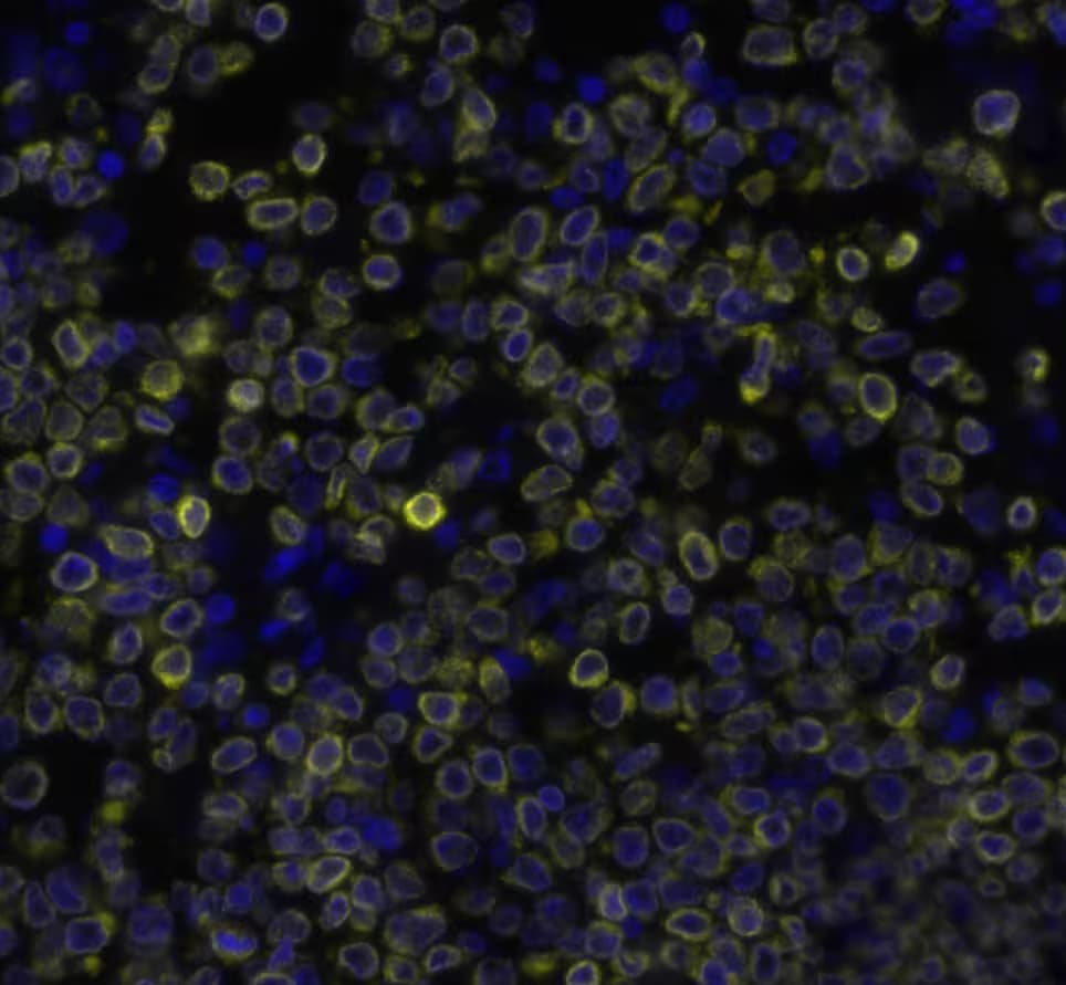 Bcl-2 Antibody (100/D5) Detection of BCL2 in Human Non-Hodgkin’s Lymphoma via seqIF™ staining on COMET™