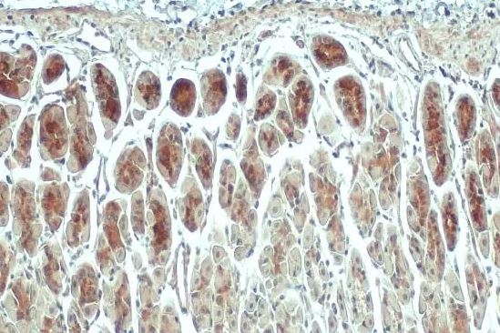 ACSL3 Antibody