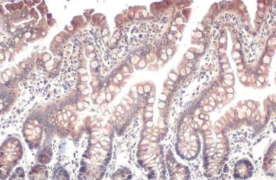 ACSL3 Antibody