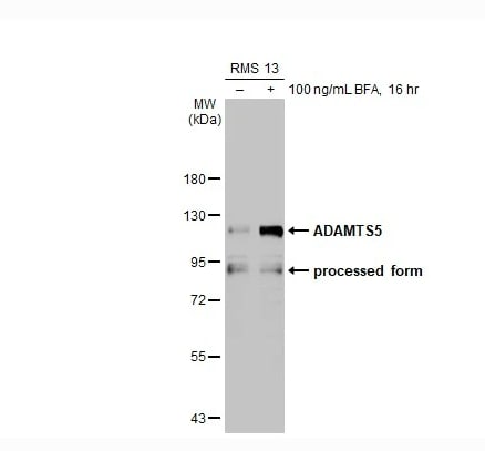 ADAMTS5 Antibody