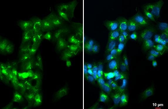 Apolipoprotein A-I/ApoA1 Antibody