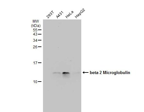 beta 2-Microglobulin Antibody