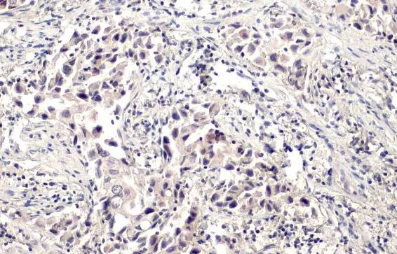 BRD1 Antibody