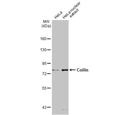 Coilin Antibody