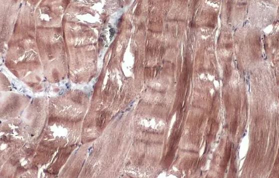 Creatine Kinase, Muscle/CKMM Antibody