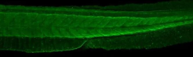 Ezrin Antibody