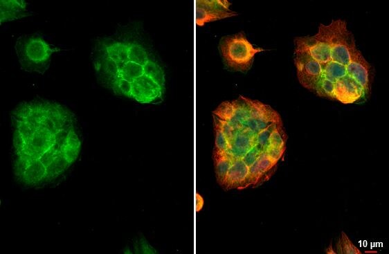 FCER1G Antibody