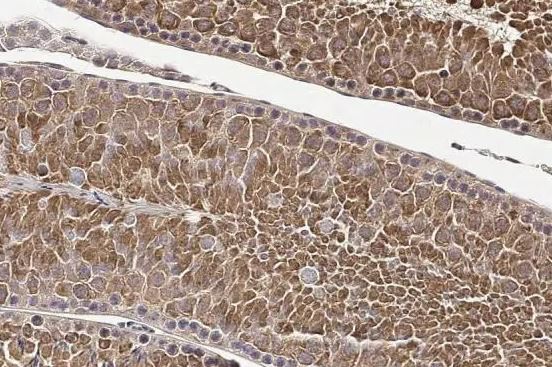 PABP Antibody