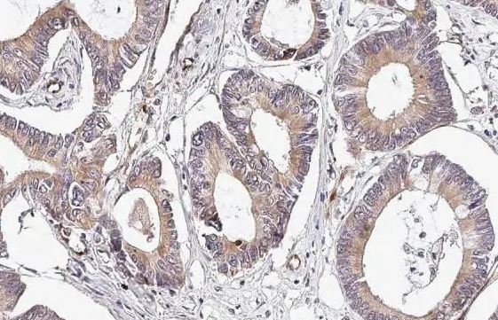 PLVAP Antibody