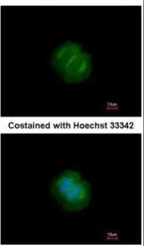 Tankyrase 1 Antibody - BSA Free