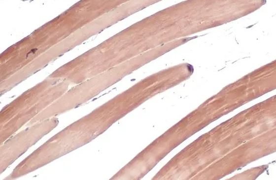 TRIM72 Antibody