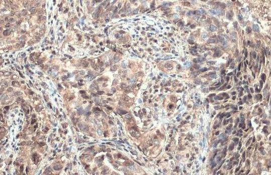 ULBP-1 Antibody