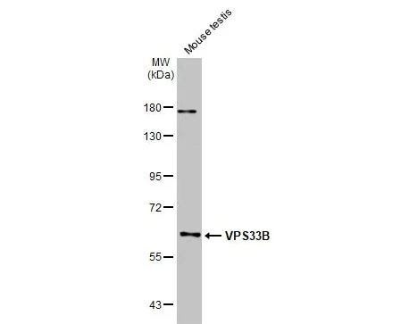 VPS33B Antibody