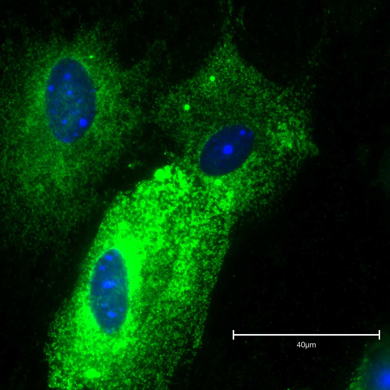 Adiponectin/Acrp30 Antibody (19F1)