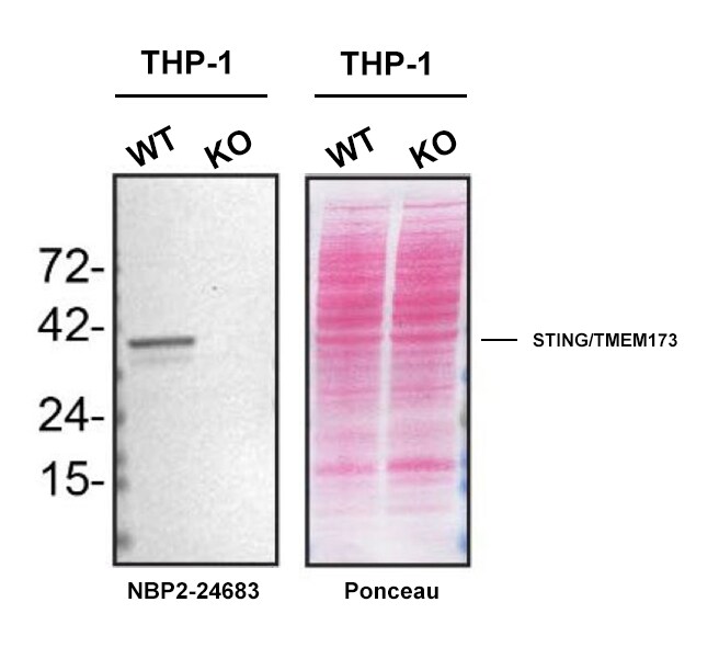 STING/TMEM173 Antibody - BSA Free