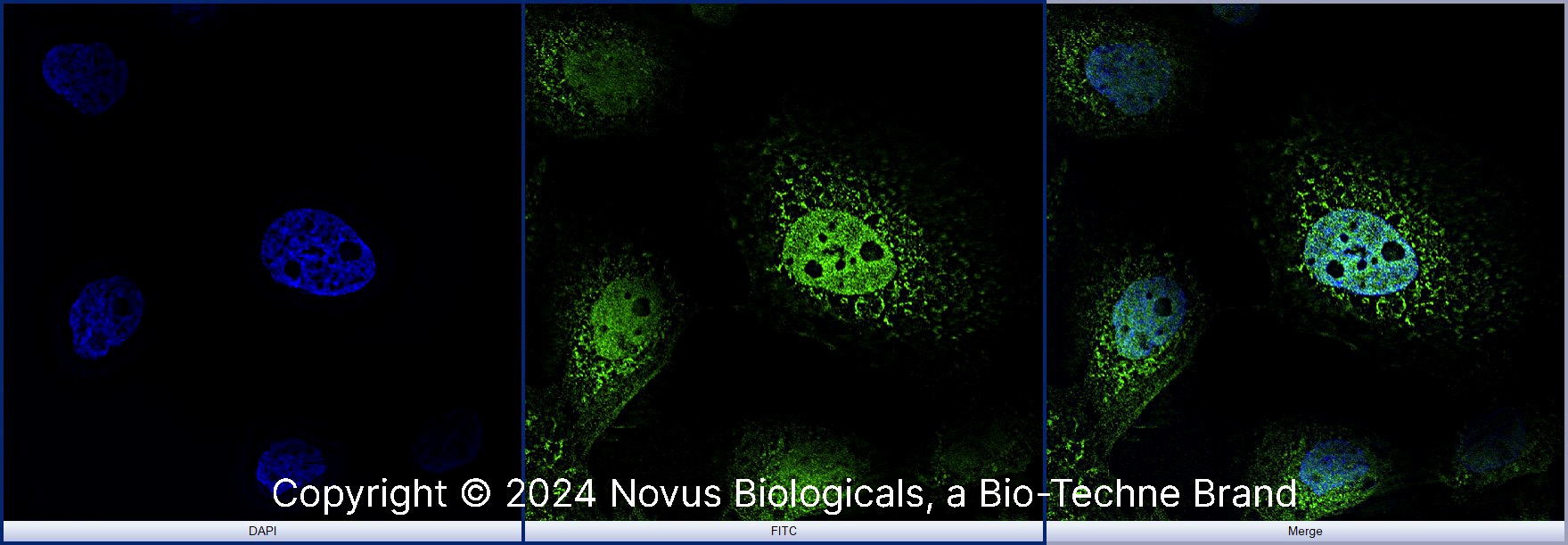 STAT6 Antibody (177C322.1) - BSA Free