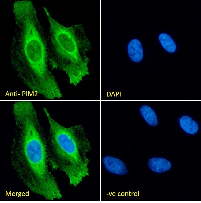 PIM2 Antibody
