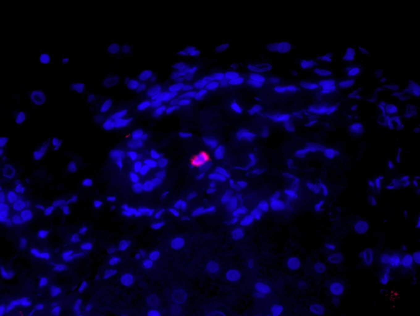 Tryptase alpha/beta 1 Antibody (AA1)