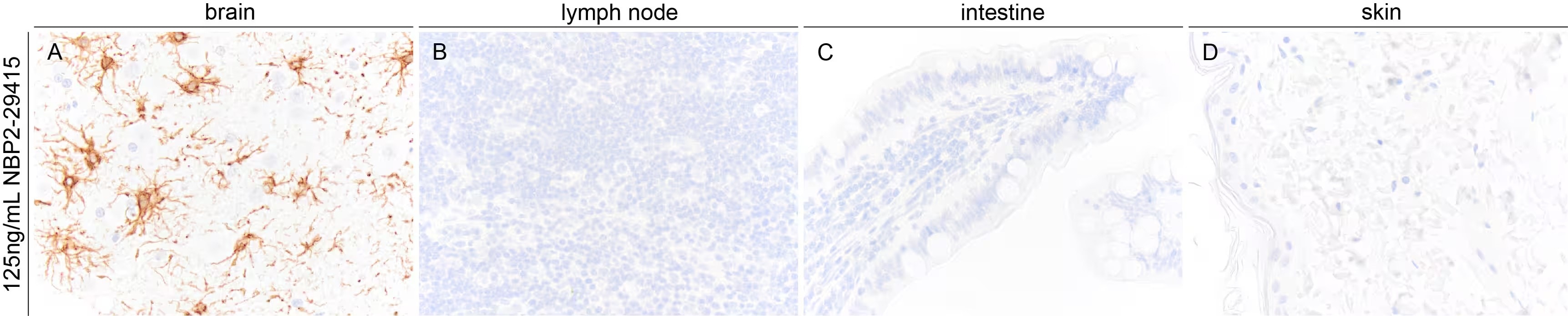 GFAP Antibody (GA-5)