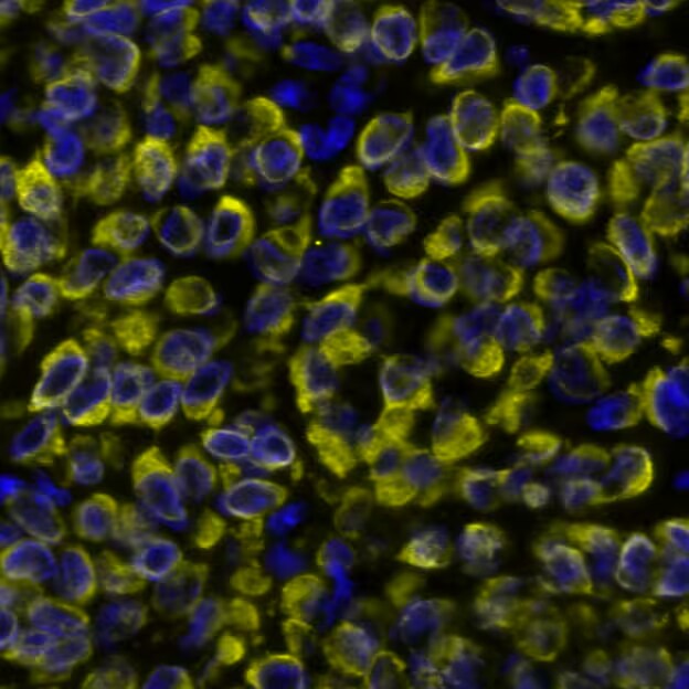 Cytokeratin, pan Antibody (AE-1/AE-3)