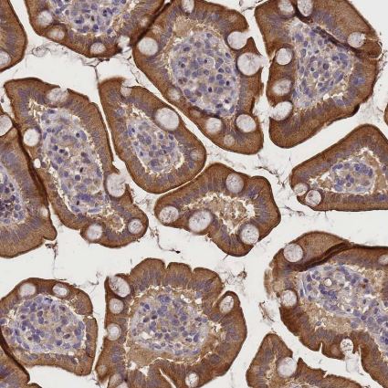 Lgi4 Antibody