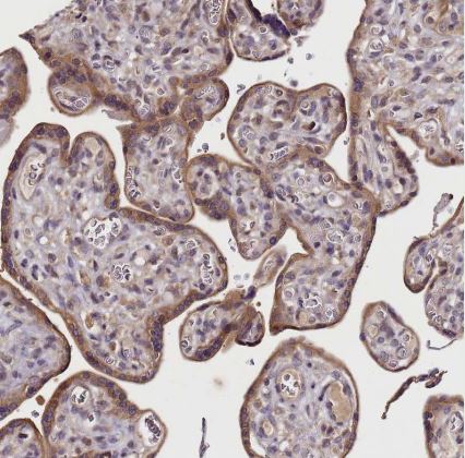 Lgi4 Antibody