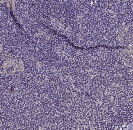 Lgi4 Antibody