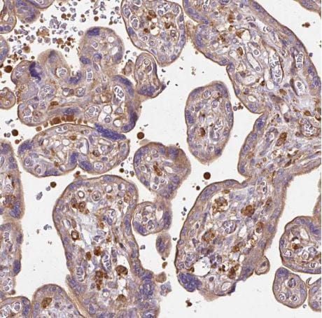 TBC1D2B Antibody