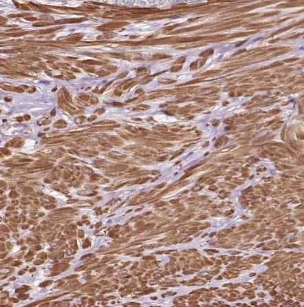 TBC1D2B Antibody