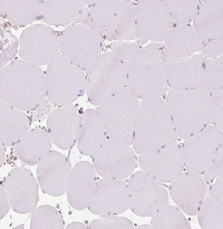 TBC1D2B Antibody