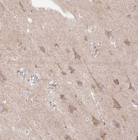 TM2D3 Antibody