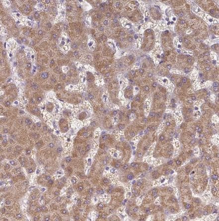 TM2D3 Antibody