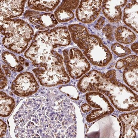 TM2D3 Antibody