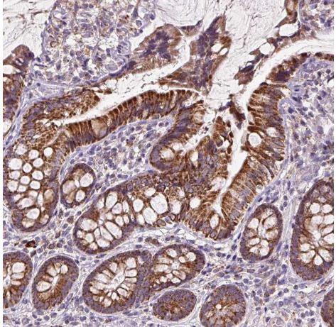 TM2D3 Antibody