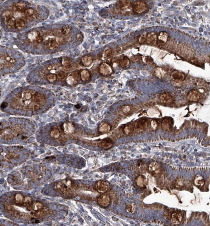 ABHD18 Antibody - BSA Free