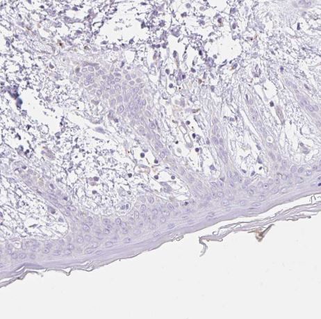 CLEC3A Antibody