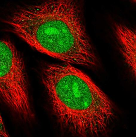 Replication Termination Factor 2 Antibody