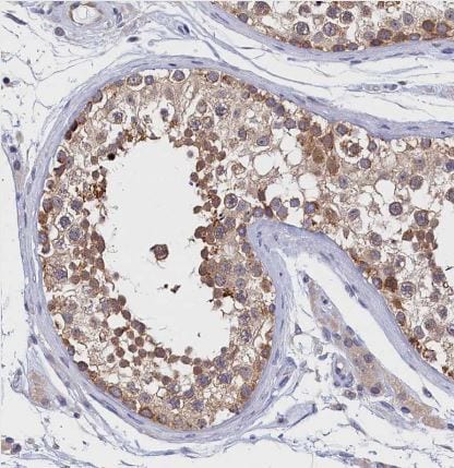 PGPase Antibody