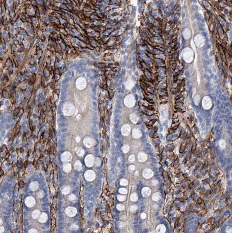 ALG14 Antibody - BSA Free