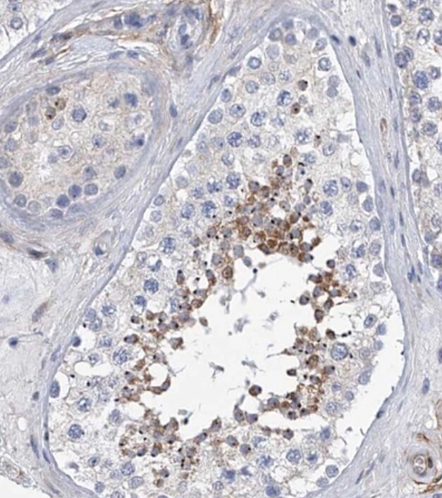 ALG14 Antibody - BSA Free