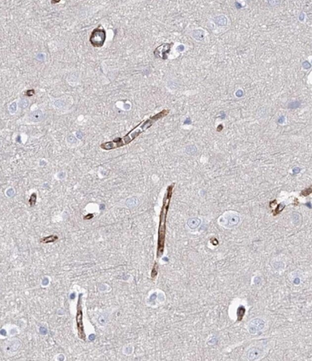 ALG14 Antibody - BSA Free