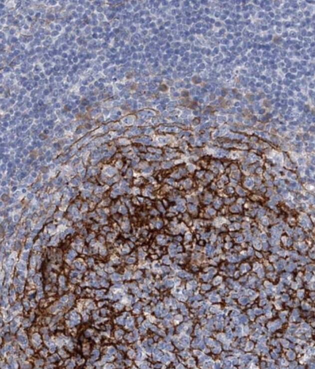 ALG14 Antibody - BSA Free
