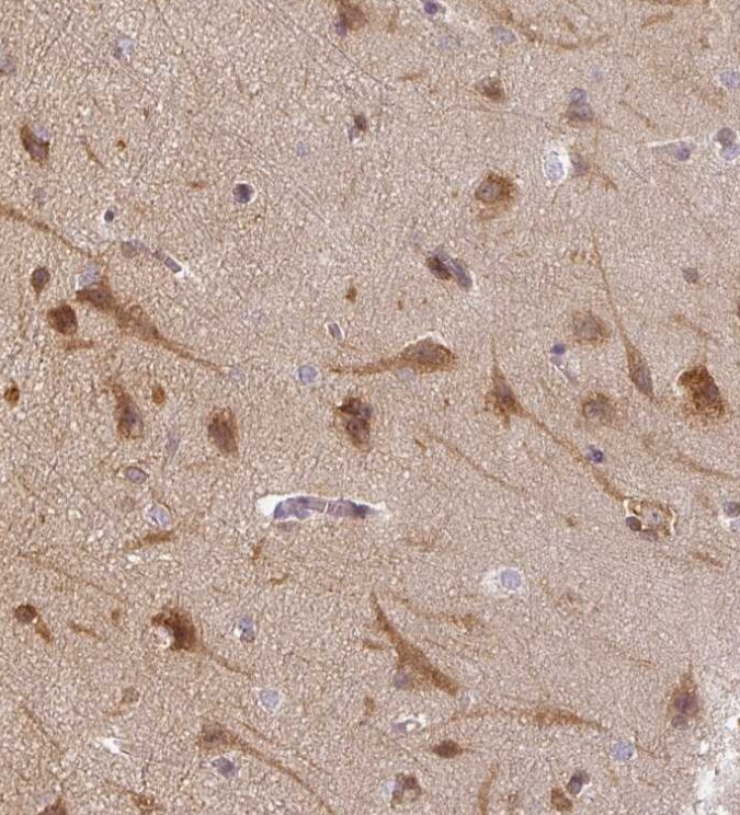 Agpat4 Antibody - BSA Free