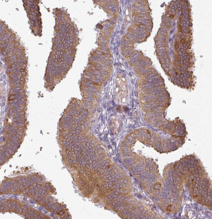 Agpat4 Antibody - BSA Free