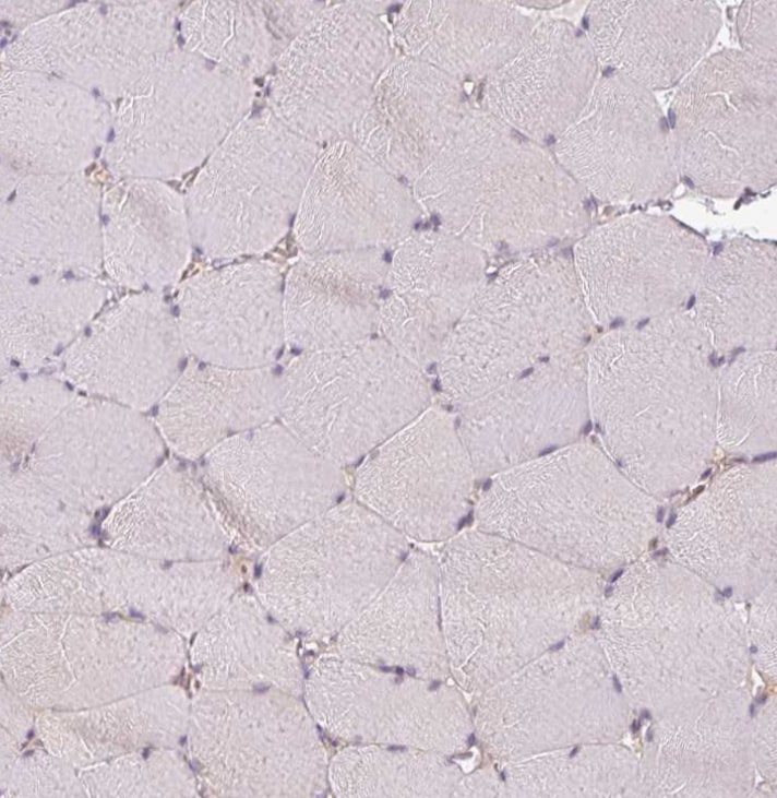 Agpat4 Antibody - BSA Free